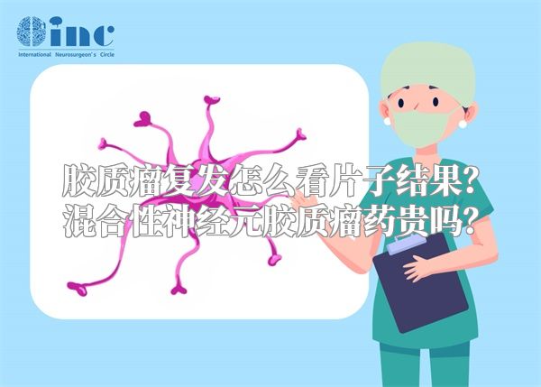 胶质瘤复发怎么看片子结果？混合性神经元胶质瘤药贵吗？