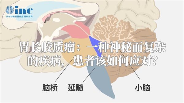 胃长胶质瘤：一种神秘而复杂的疾病，患者该如何应对？
