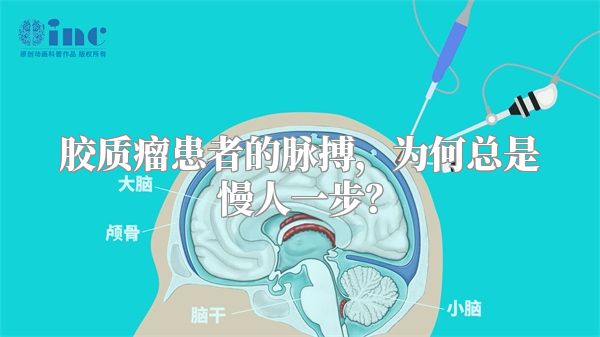 胶质瘤患者的脉搏，为何总是慢人一步？