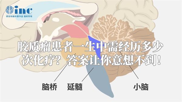 胶质瘤患者一生中需经历多少次化疗？答案让你意想不到！