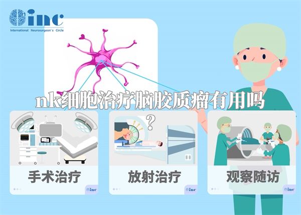 nk细胞治疗脑胶质瘤有用吗？