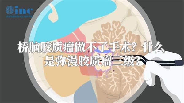 桥脑胶质瘤做不了手术？什么是弥漫胶质瘤三级？