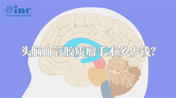 头脑血管胶质瘤手术多少钱？