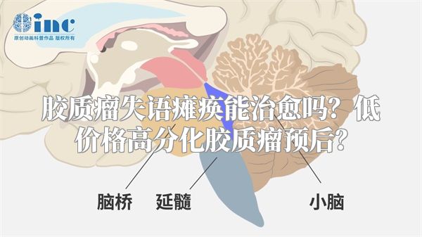 胶质瘤失语瘫痪能治愈吗？低价格高分化胶质瘤预后？