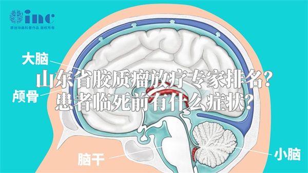 山东省胶质瘤放疗专家排名？患者临死前有什么症状？