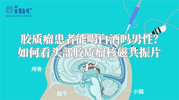 胶质瘤患者能喝白酒吗男性？如何看头部胶质瘤核磁共振片子？