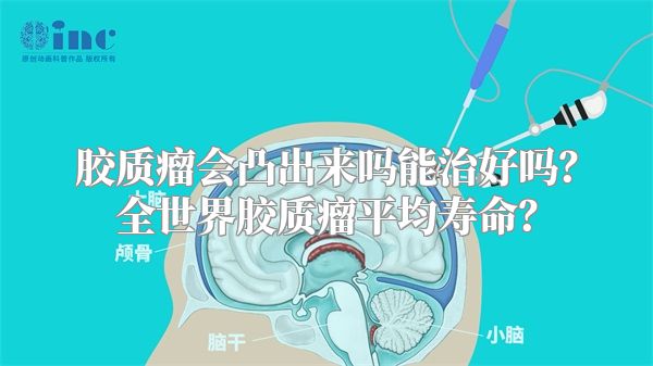 胶质瘤会凸出来吗能治好吗？全世界胶质瘤平均寿命？