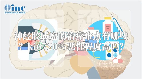 神经胶质瘤的治疗难点有哪些？ki6720%恶性程度高吗？