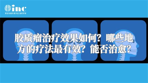 胶质瘤治疗效果如何？哪些地方的疗法最有效？能否治愈？