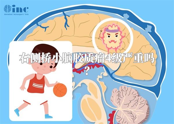 右侧桥小脑胶质瘤4级严重吗？