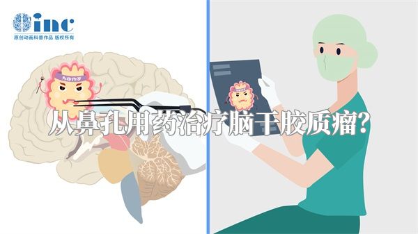从鼻孔用药治疗脑干胶质瘤？