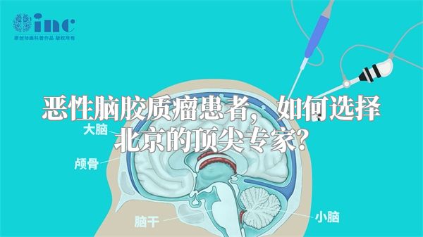 恶性脑胶质瘤患者，如何选择北京的顶尖专家？