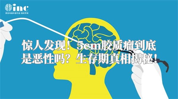 惊人发现！5cm胶质瘤到底是恶性吗？生存期真相揭秘！