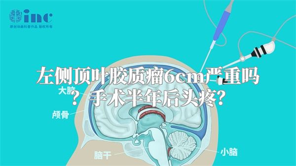 左侧顶叶胶质瘤6cm严重吗？手术半年后头疼？