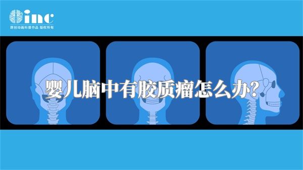 婴儿脑中有胶质瘤怎么办？