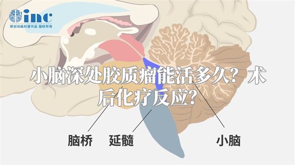 小脑深处胶质瘤能活多久？术后化疗反应？