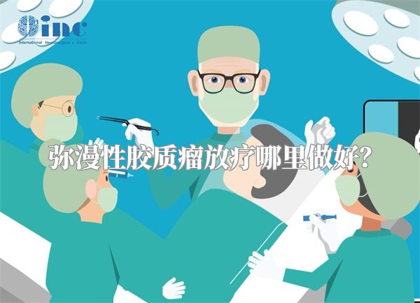 弥漫性胶质瘤放疗哪里做好？