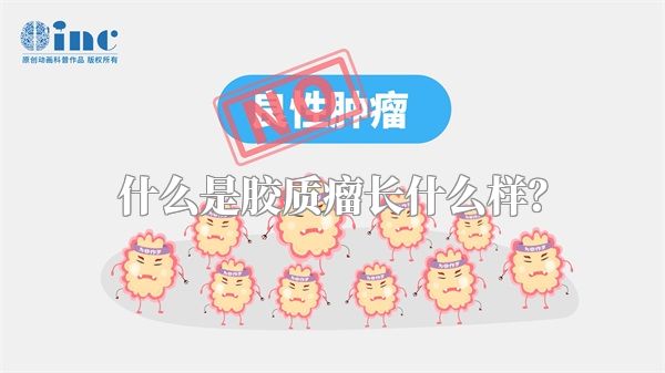 什么是胶质瘤长什么样？