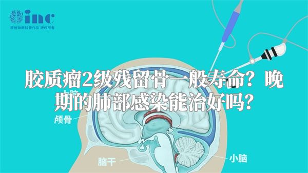 胶质瘤2级残留骨一般寿命？晚期的肺部感染能治好吗？
