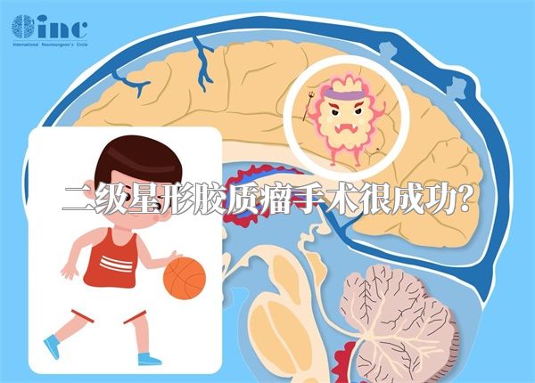 二级星形胶质瘤手术很成功？