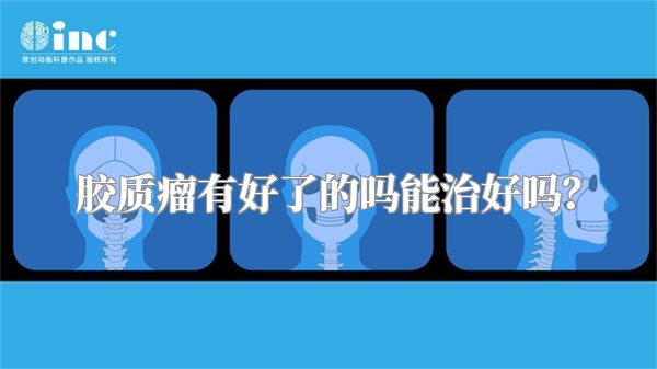 胶质瘤有好了的吗能治好吗？