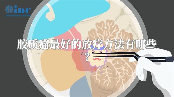 胶质瘤最好的放疗方法有哪些？