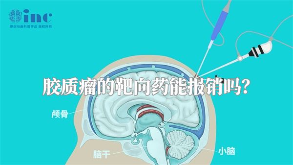 胶质瘤的靶向药能报销吗？