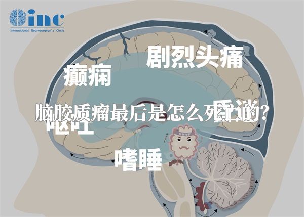 脑胶质瘤最后是怎么死亡的？