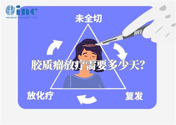 胶质瘤放疗需要多少天？