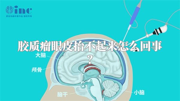 胶质瘤眼皮抬不起来怎么回事？