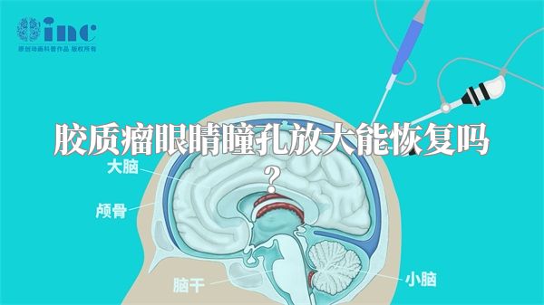 胶质瘤眼睛瞳孔放大能恢复吗？