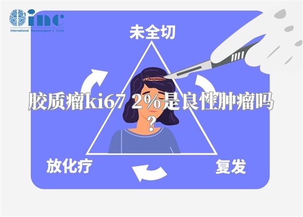 胶质瘤ki67 2%是良性肿瘤吗？