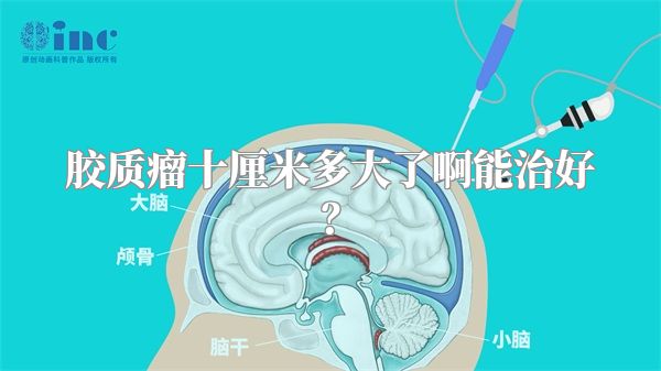 胶质瘤十厘米多大了啊能治好？