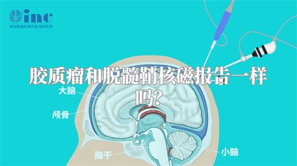 胶质瘤和脱髓鞘核磁报告一样吗？