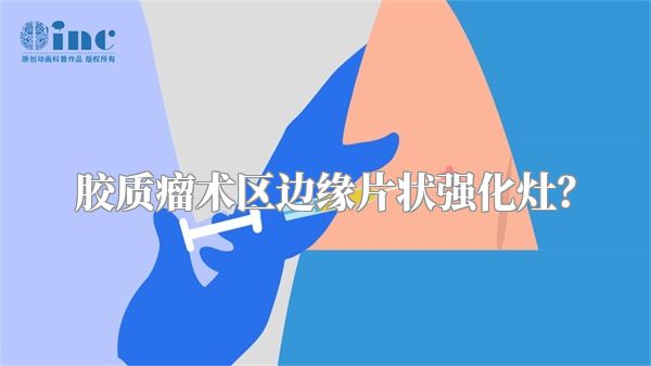 胶质瘤术区边缘片状强化灶？