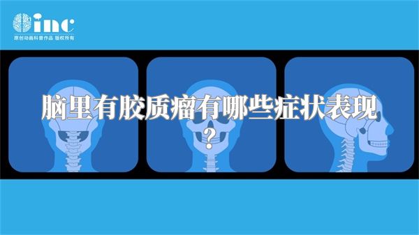 脑里有胶质瘤有哪些症状表现？