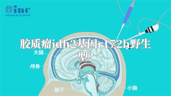 胶质瘤idh2基因r172h野生型？