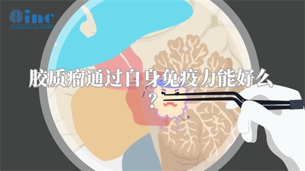 胶质瘤通过自身免疫力能好么？