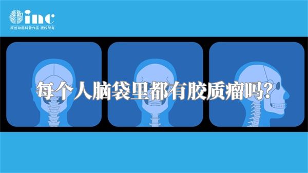 每个人脑袋里都有胶质瘤吗？