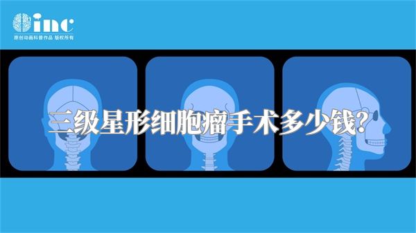 三级星形细胞瘤手术多少钱？