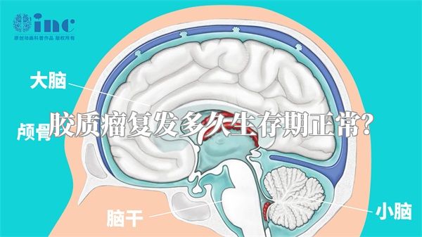 胶质瘤复发多久生存期正常？