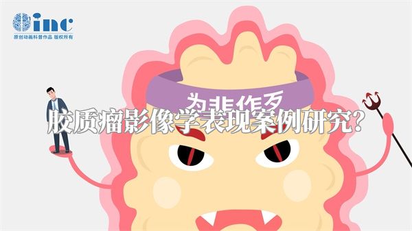 胶质瘤影像学表现案例研究？