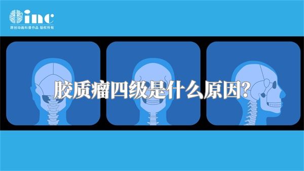 胶质瘤四级是什么原因？