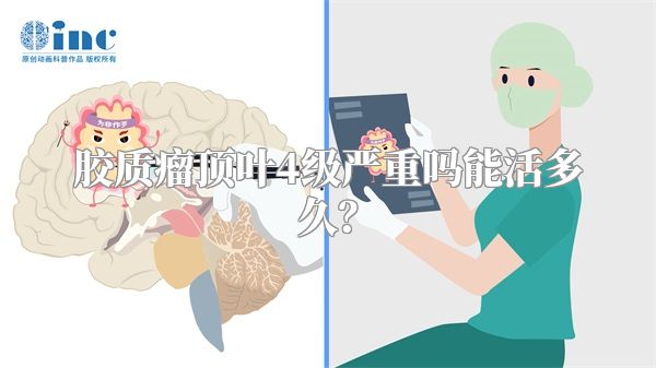胶质瘤顶叶4级严重吗能活多久？