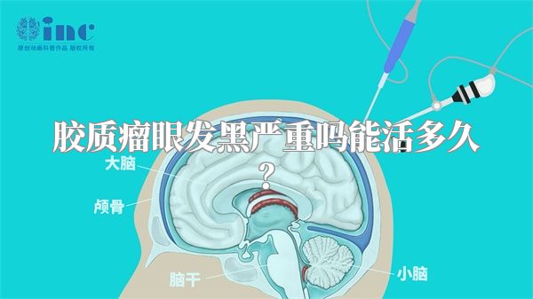 胶质瘤眼发黑严重吗能活多久？