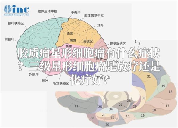 胶质瘤星形细胞瘤有什么症状？三级星形细胞瘤是放疗还是化疗好？