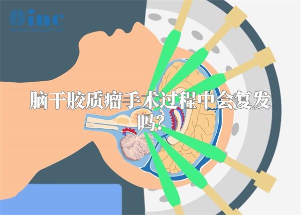 脑干胶质瘤手术过程中会复发吗？