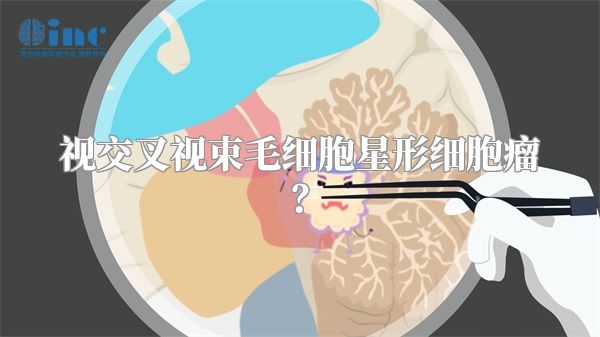 视交叉视束毛细胞星形细胞瘤？