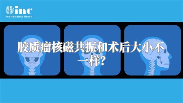 胶质瘤核磁共振和术后大小不一样？