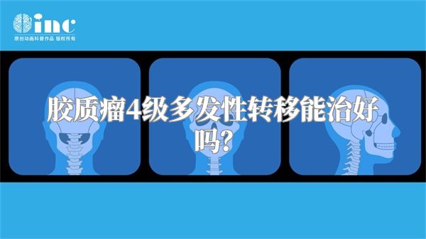 胶质瘤4级多发性转移能治好吗？